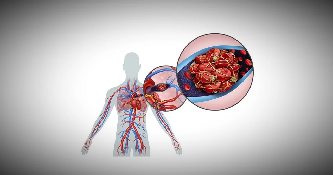 La connexion entre l'embolie et l'anémie